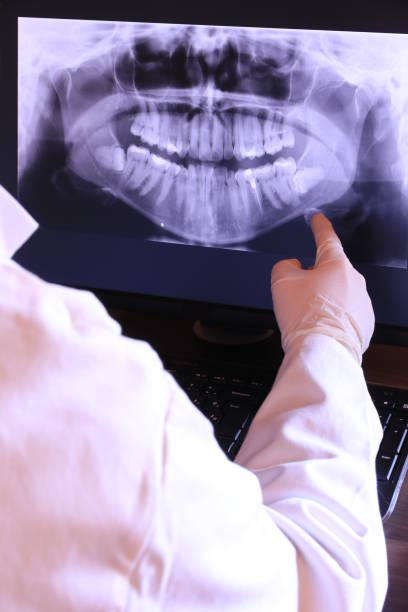 Best Emergency Tooth Extraction in Ringwood, NJ